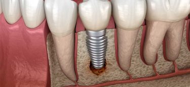 Periodontics-Houston